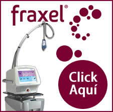 Fraxel... muy pronto!