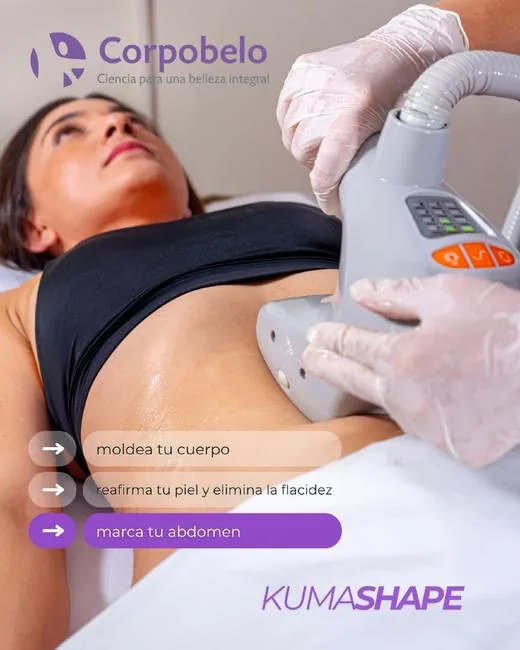 Tratamiento KumaShape para definir abdomen